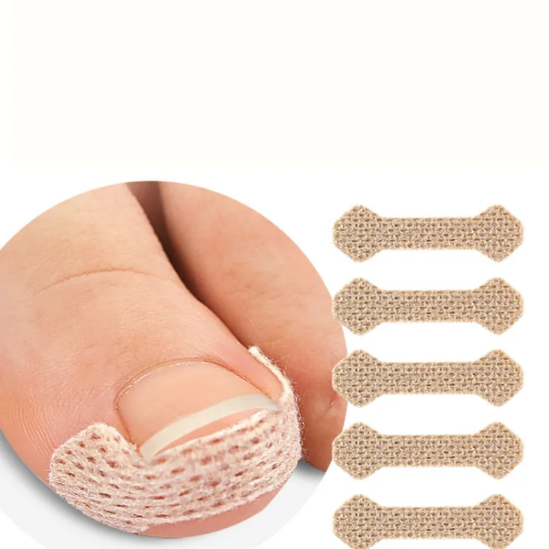 40/100pcs Nail Correction Stickers Ingrown Toenail Corrector Patches Treatment Recover Corrector Pedicure Care Tool 5