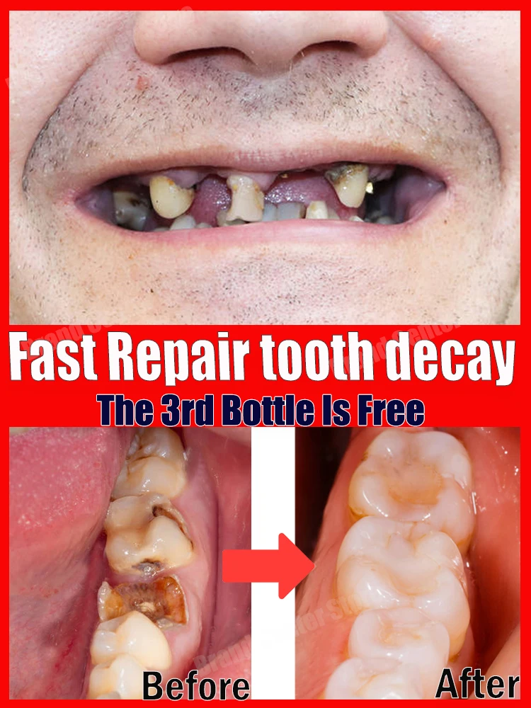 Tooth-saver.jpg