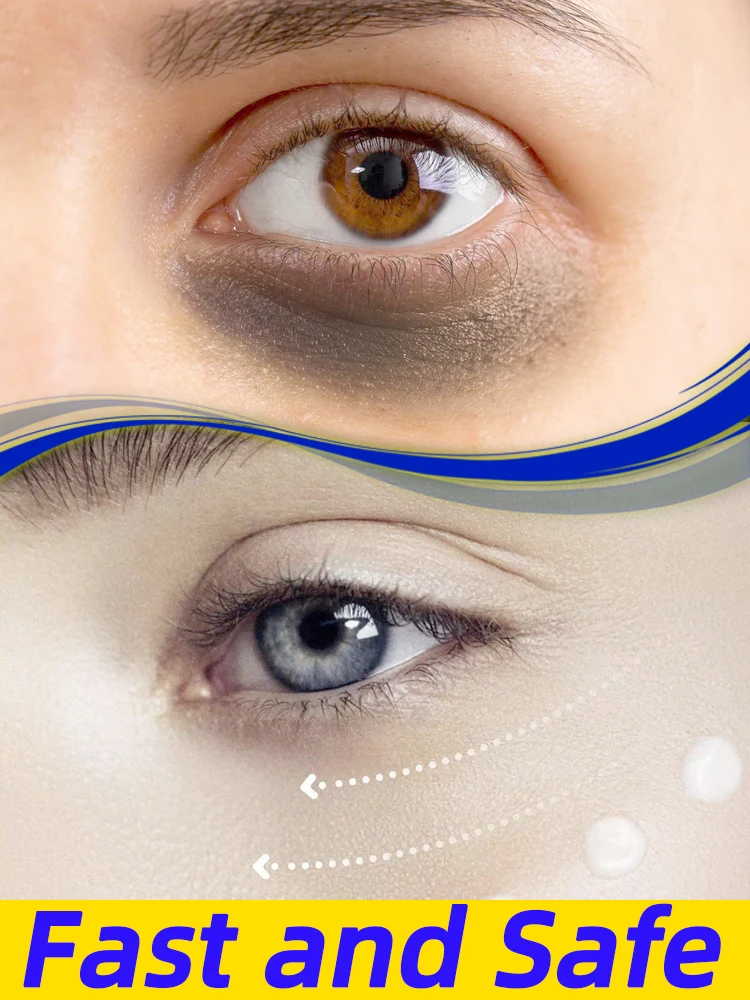 Eye Cream Eyes Bags Wrinkle Dark Circles anti wrinkle eye cream eye cream