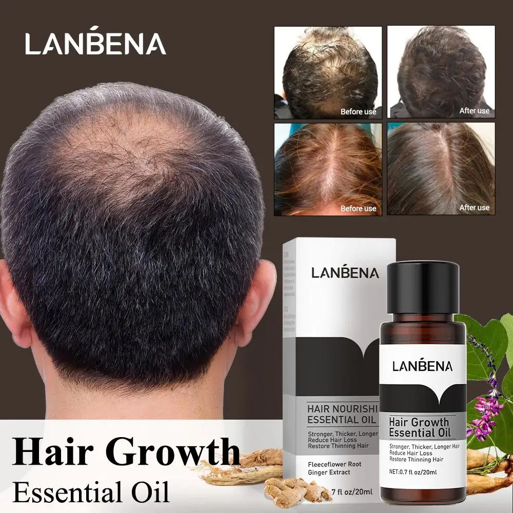 10PCS LANBENA Hair Growth Essence Hair Care Treatment For Men And Women Hair Loss Essential Oil Liquid Treatment Hair Care images - 6