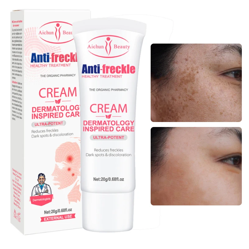 

Отбеливающий крем для веснушек, удаление мелазмы, осветление, увлажнение, омоложение, осветление, уход за кожей лица 20 г