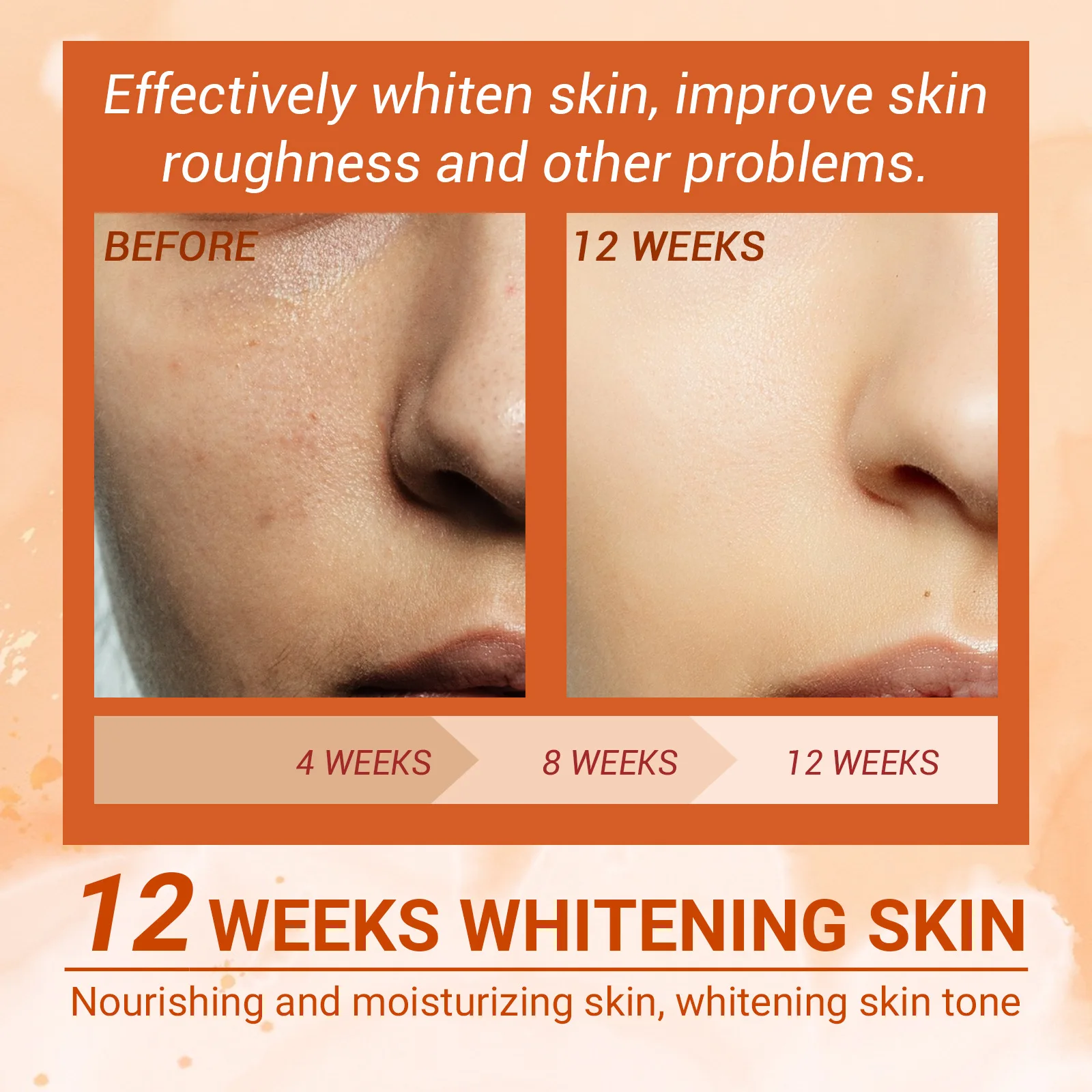 Siero viso sbiancante per lentiggini alla vitamina C Rimuovi le macchie scure Dissolvenza Melasma Anti-età Illumina Tonico idratante all'essenza_voghion.com