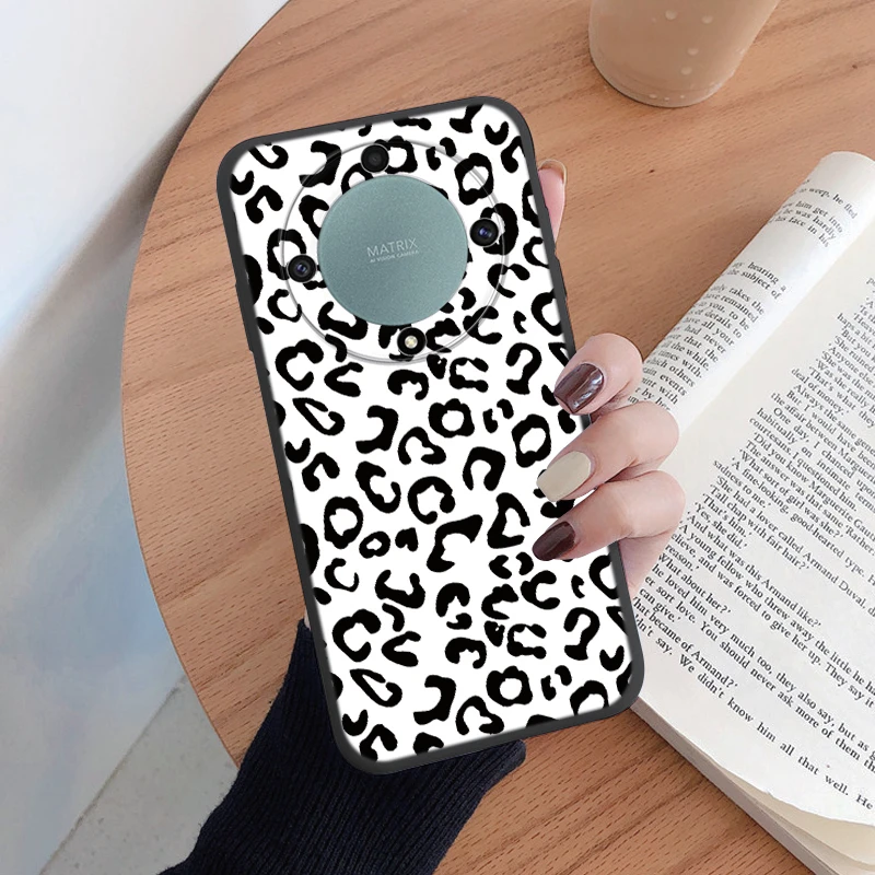 Für Honor X9a X9b X9c Magic5 6 7 Lite 5G Fall Mode Leopard Print Zurück Abdeckung Weiche TPU stoßfest Funda Marmor Textur Shell – Detail 15