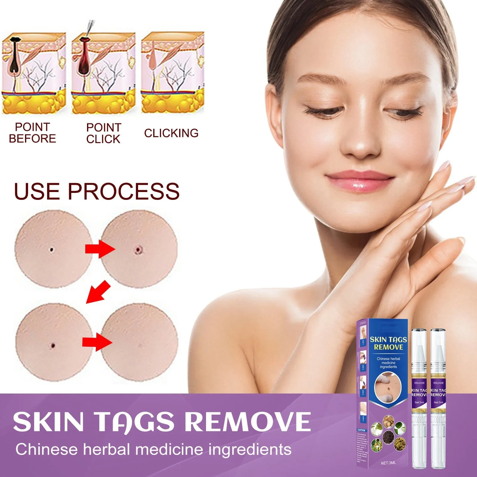 Wart Removal Gel Pen