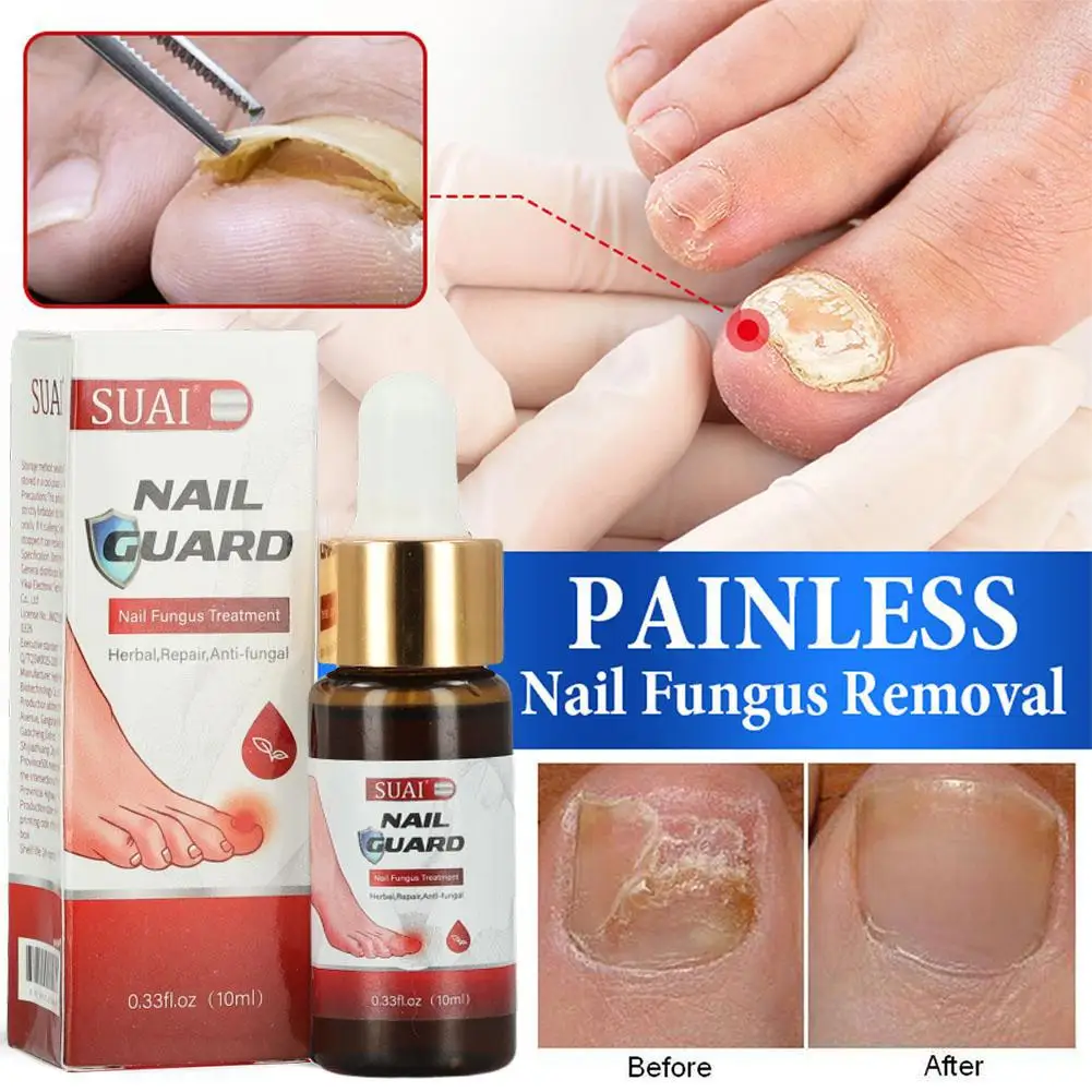 Antifungal – nail growth stimulator, 15 ml.