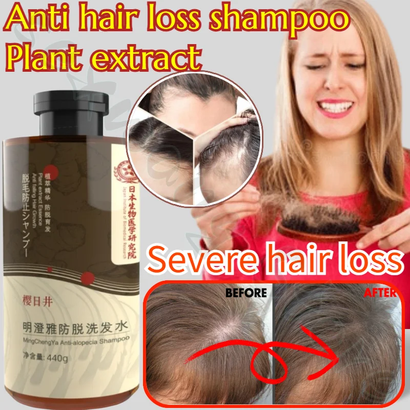 Anti-hair Loss Shampoo Herbal Essence Shampoo Improves Hair Loss, Removes Dandruff, Relieves Itching, Smoothes and Controls Oil scalp cleansing shampoo is clean refreshing and smooth it controls oil removes dandruff and protects hair follicles