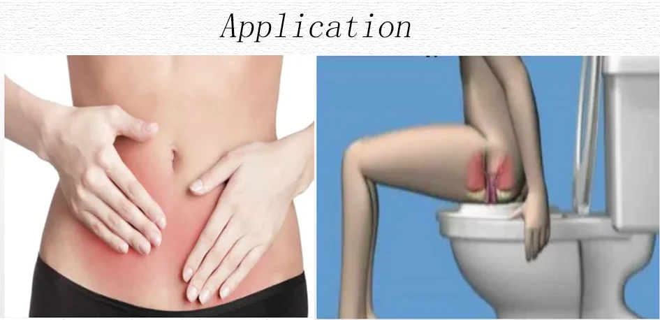 Professional Vaginal Insert Gynecological O3 Therapy Included Kit Vaginal Ozone Insufflation