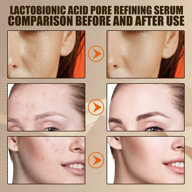 Facial Serum Lactobionic Acid Pore Shrink Hyaluronic Acid Moisturizing Nourishing Essence Firming Brighten Korean Cosmetics facial serum