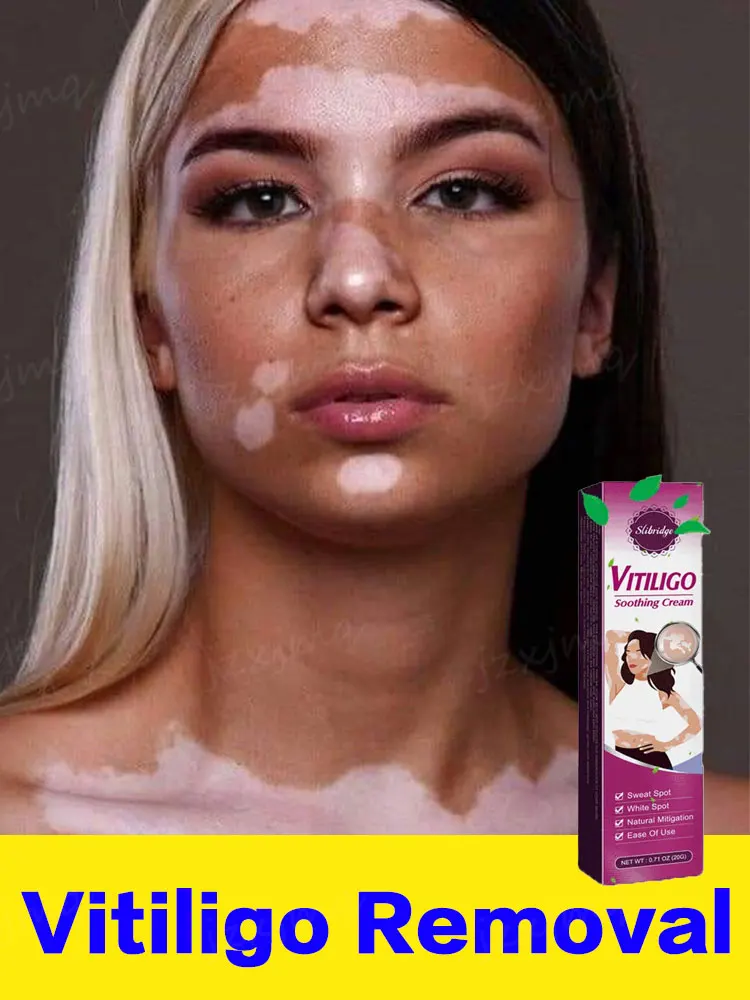 

Vitiligo Repair Cream Ointment Skin Treatment