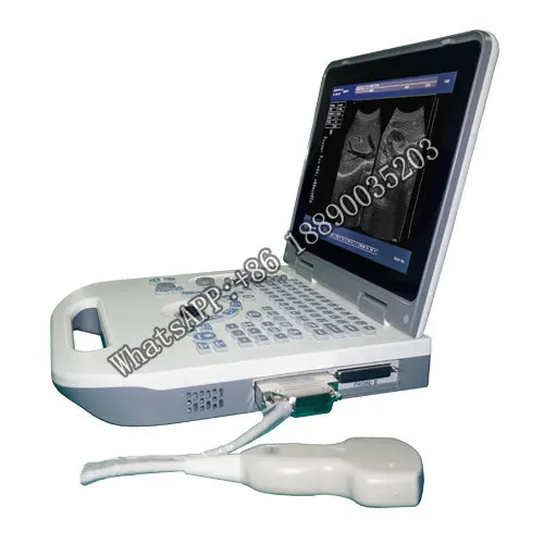 

Cheapest and affordable Full Digital Black White Portable Human Veterinary Ultrasound Scanner factory price