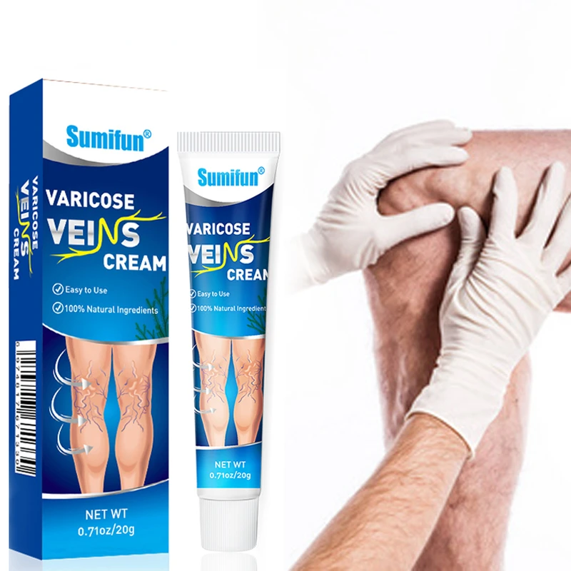

Sumifun Varicose Veins Treatment Cream Effective Cure Leg Acid Vasculitis Phlebitis Spider Veins Pain Relief Angiitis Ointment