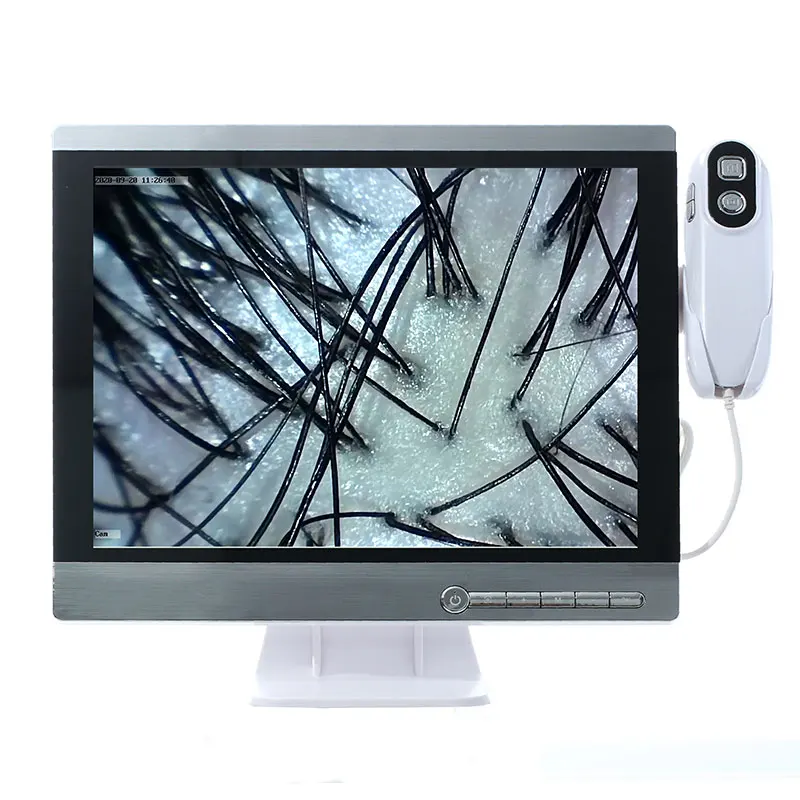 High Quality 15.5 Inch Scalp Detector Hair Test Analyzer Microscopic Skin Scalp And Hair Camera / Microscope Camera