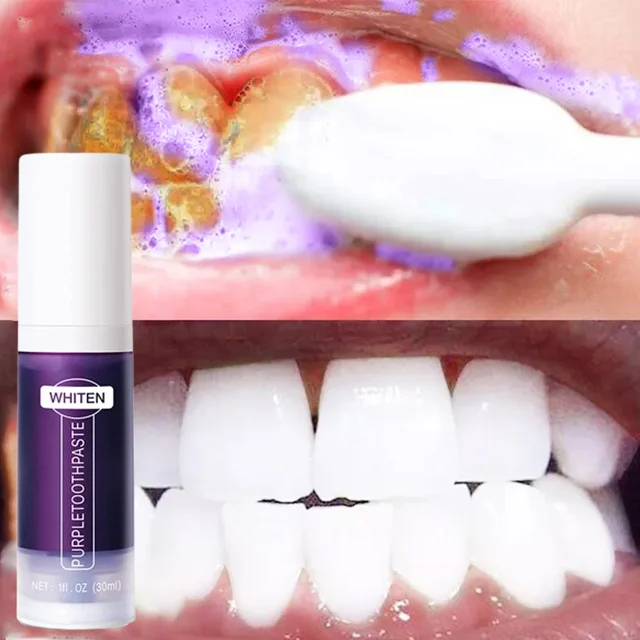 Teeth Whitening Toothpaste 5d Tooth Whitener Strips Oral Hygiene Cleaning Dental Bleaching Tools Fresh Breath Dentistry Care New 1