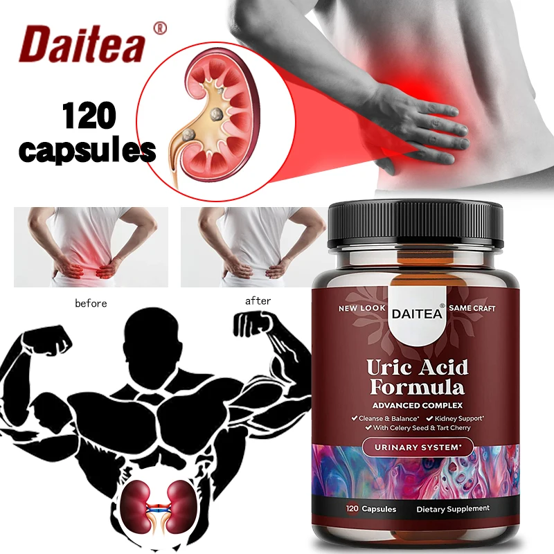 Uric Acid Cleanse Supplement Herbal Uric Acid Cleanse & Detox &ndash; Daily Kidney Cleanse & Uric Acid for Adults &ndash; Joint Support Supplement Detox