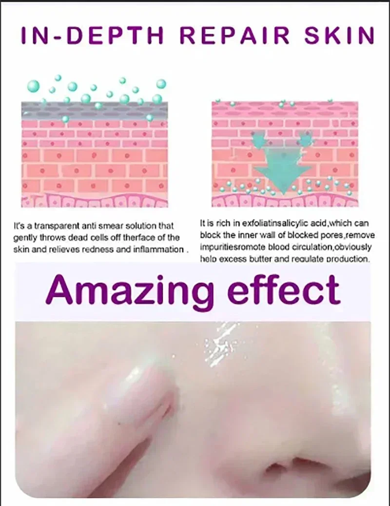 Pore Shrinking Serum Moisturizing Facial Essence for Relieving Dryness Oil Long-lasting Calming for Sensitive Skin Care 4