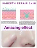 Pore Shrinking Serum Moisturizing Facial Essence for Relieving Dryness Oil Long-lasting Calming for Sensitive Skin Care 4