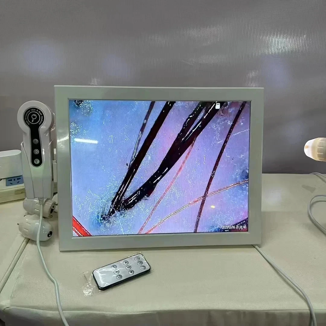 2024 HD  Ǻ м,    ī޶ ,    ׽Ʈ ġ, 15 ġ
