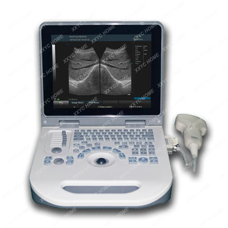 

Mindray Vet Ultrasound Portable veterinary machine price