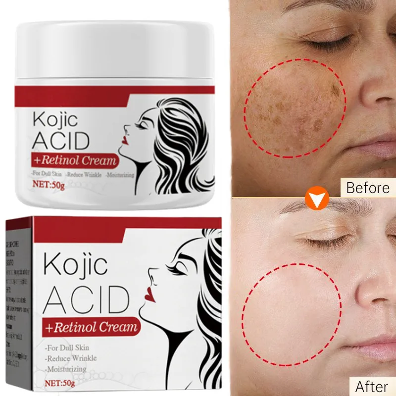 

50G Kojic Acid Cream Remove Pigment Melanin Whitening Remove Dark Spots Cream Nourishing & Resurfacing Fade Face Cream