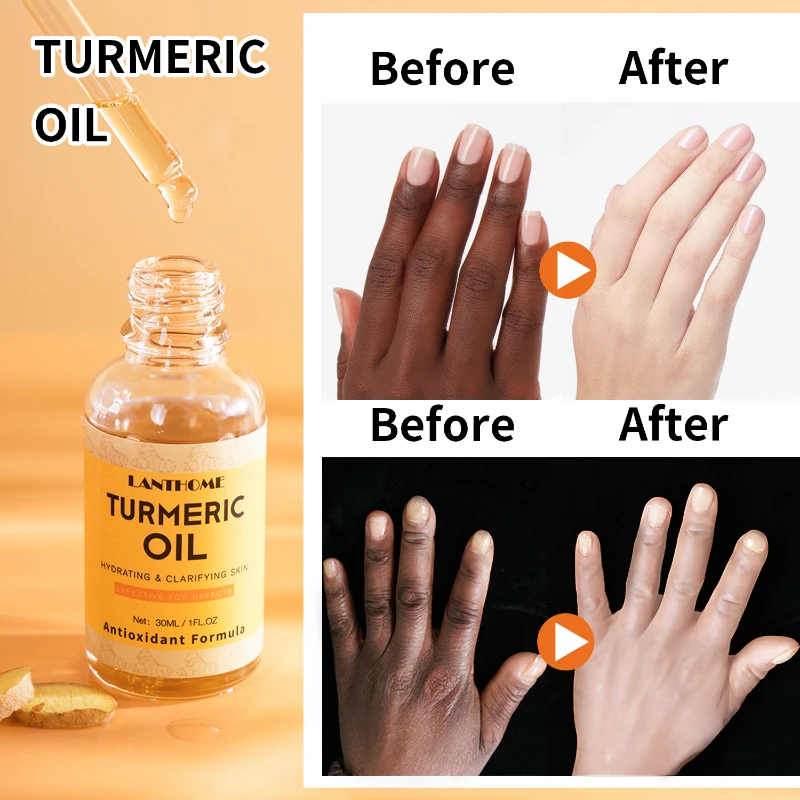 Turmeric Body Essential Oil Glow to Facial Lightening Brightening Serum For Black Brown Skin Corrector Skin Whitening Oil Serum lanthome glutathione whitening serum fade black dark spots vitamin c defects reduce facial oil brightening firming for women