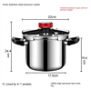 304 Stainless Steel Pressure Cooker Explosion-proof Household Gas Stove Thickened Pressure Cooker 4