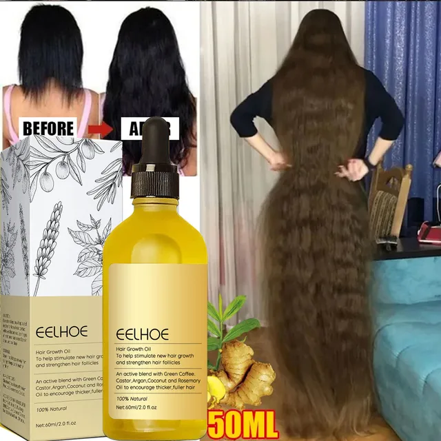 Haarwachstumsprodukte verhindern Haarausfall, ätherisches Öl, schnell wachsende Anti-Trocknungs-Kopfhautbehandlung, Reparatur, Schönheit und Gesundheit für Männer und Frauen