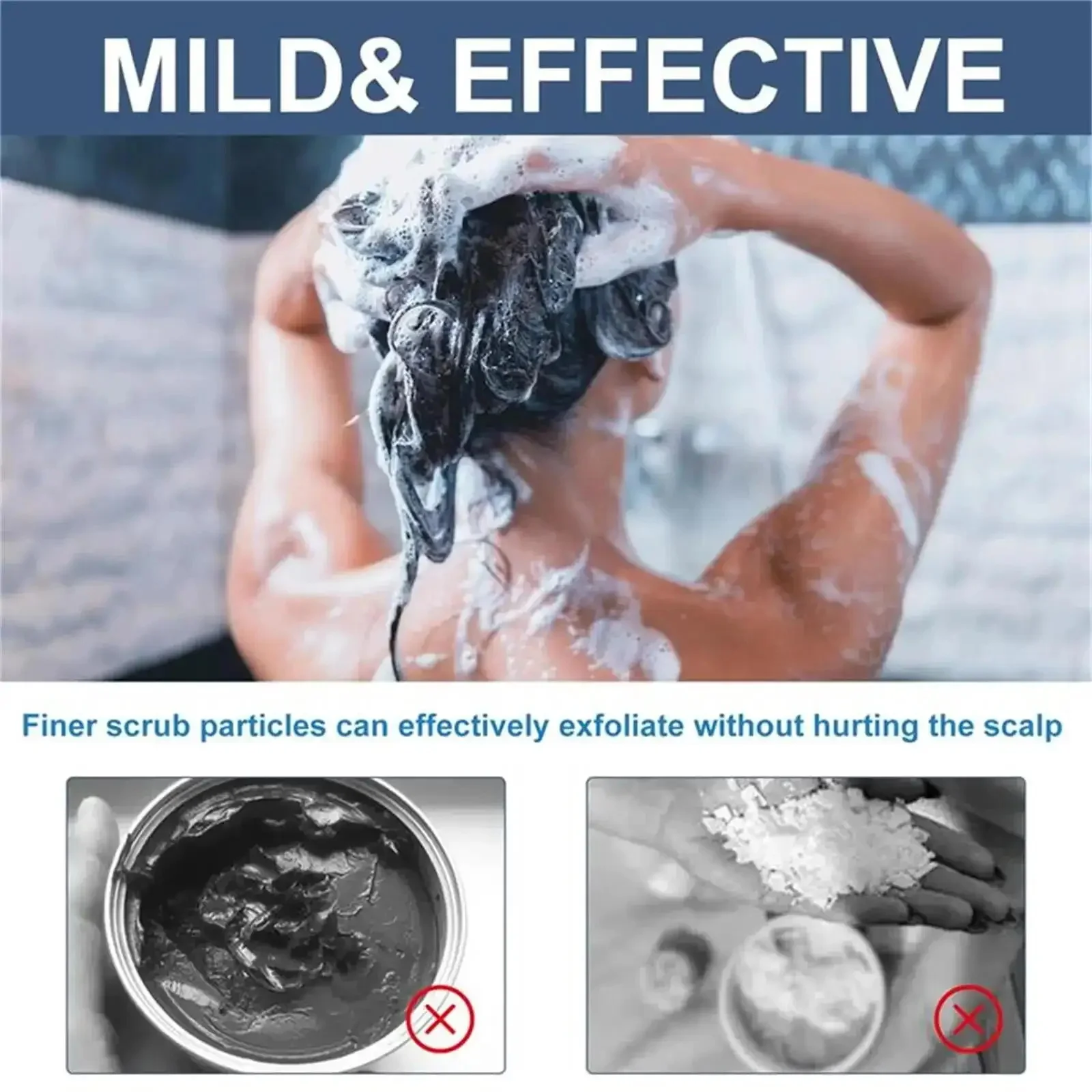 Fast Anti Exfoliating Scrub Remove Dandruff Anti Itching Treatment Seborrheic Scalp Oil Control Repair Scalp Beauty Health Care hair treatment scalp treatment