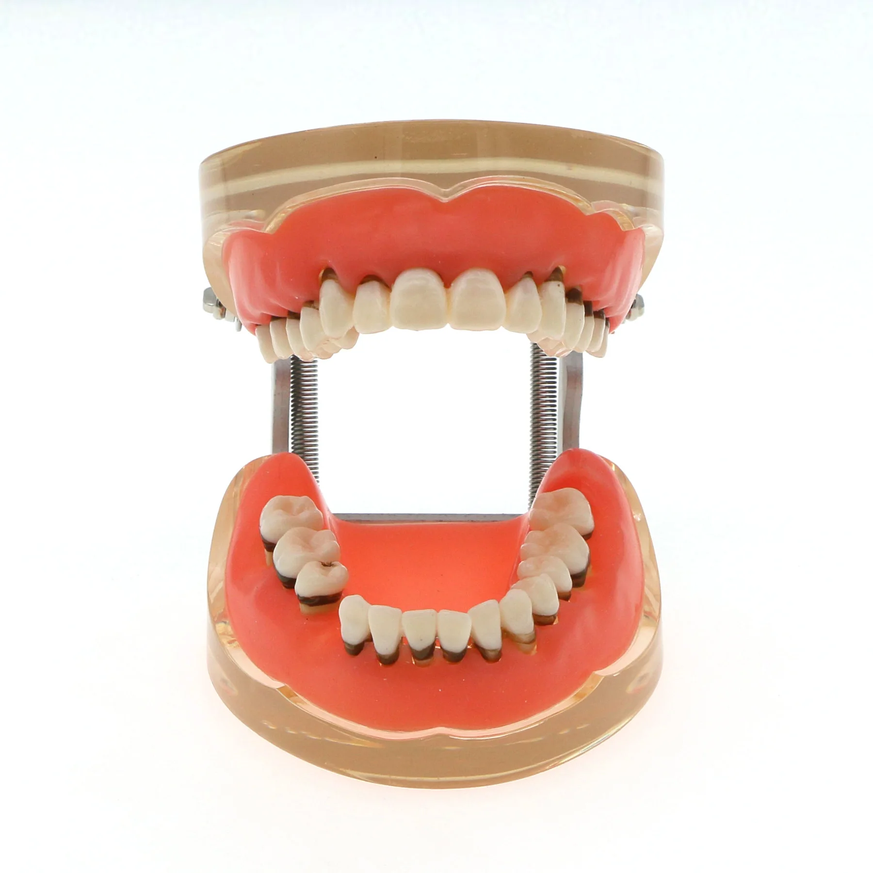 Dental Teeth Model  Dentist Teaching Model Demonstration Periodontal Disease Pathological For Patient Education Demo M4017 5
