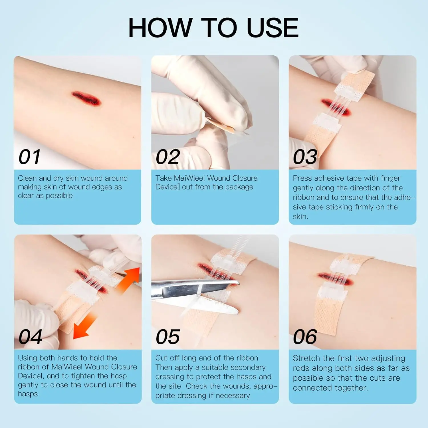 Zip Stitch Emergency Wound Closures Device Repair Wounds Without Stitches Zip Sutures Butterfly Bandaids Health Care images - 6