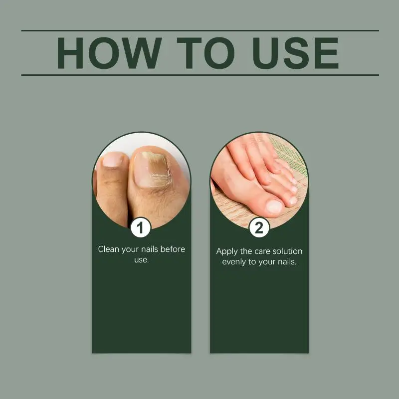 Soluzione Riparatrice per Unghie con Tea Tree e Zenzero, Nutriente per Cuticole, Anti-Infezione, Rinforzante per Piedi Danneggiati - immagine 5