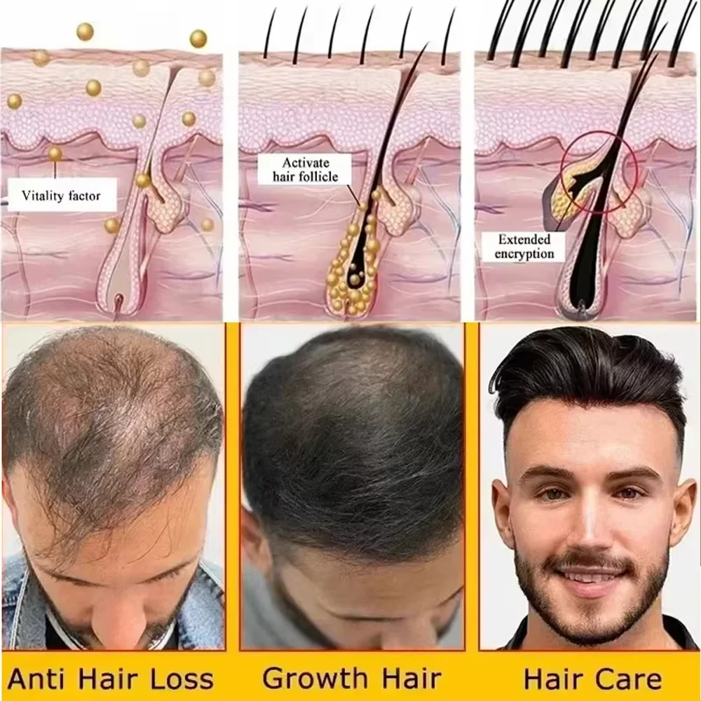 Fast Hair Growth Set Batana Oil Traction Alopecia HairS Mask Anti Break Loss Hair Growth Oil Baldness Treatment Hair Health Care 5 Fast Hair Growth Set Batana Oil Traction Alopecia HairS Mask Anti Break Loss Hair Growth Oil Baldness Treatment Hair Health Care - Image 5