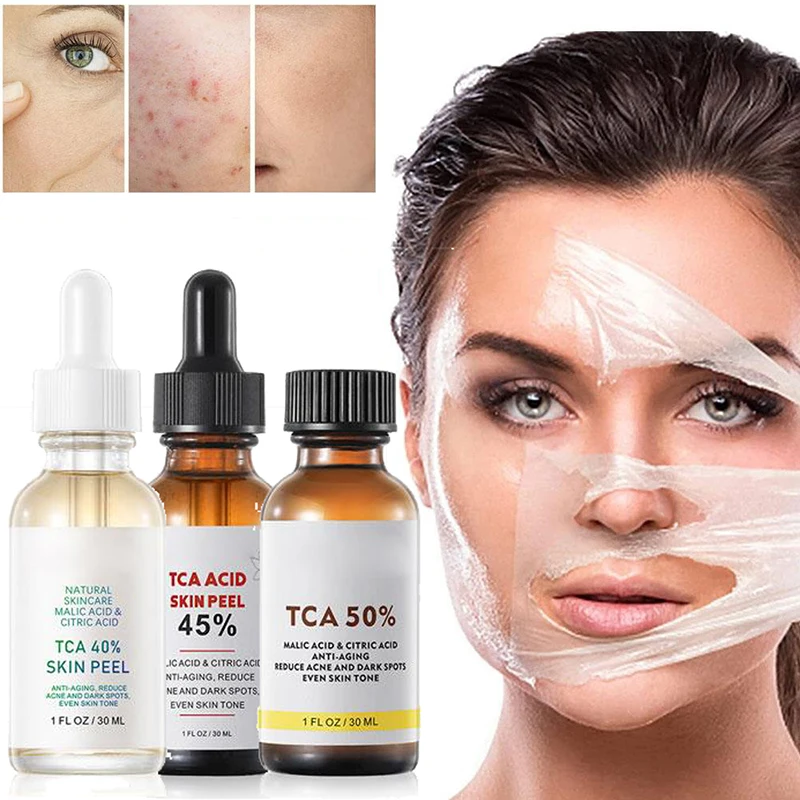 

30ml 40% 45% 50% Peel Acid Skin Peel Peeling Acid Aid Serum Skin Acid Skin Peel 20% Trichloroaectic Serum Wrinkles Q7X8