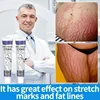 Swelling Marks Remove Skin Cracks Body Creams 5