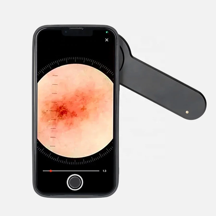 DE-3100 Handyscope Smartphone Mobile Dermatoscope Dermoscope Trichoscope