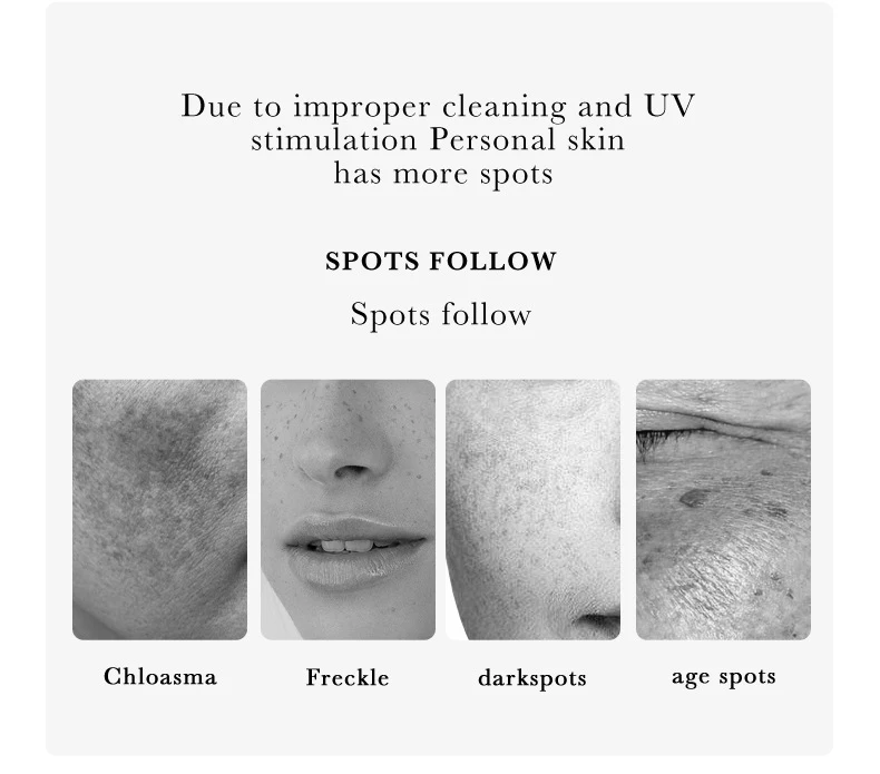 SADOER Nicotinamide Skin Care Sets Freckle Removing Whitening Moisturizing Anti-aging Face Cream Facial Serum Face Skin Care Kit