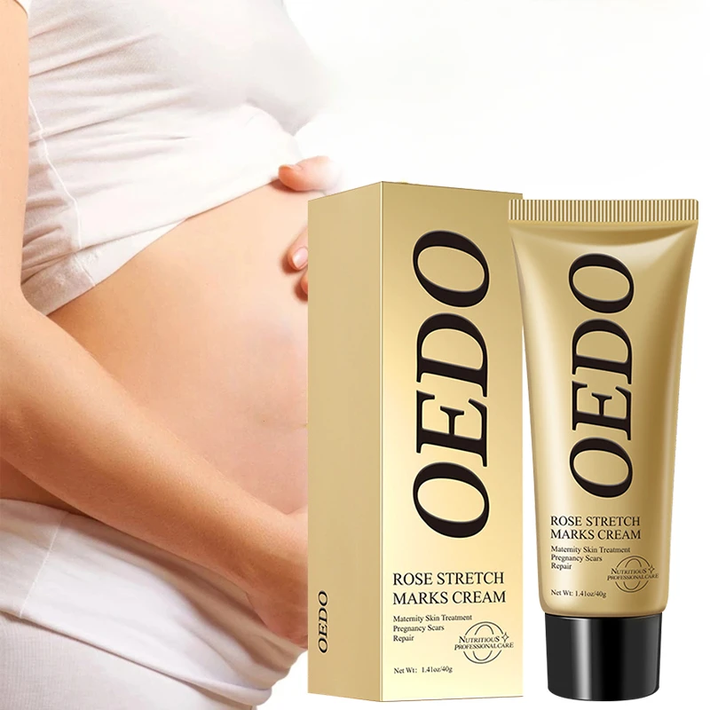 stretch marks cream Abdomen Remove Stretch Marks Cream Anti Wrinkle Anti Aging Maternity Skin Repair Remove Pregnancy Scars Treatment