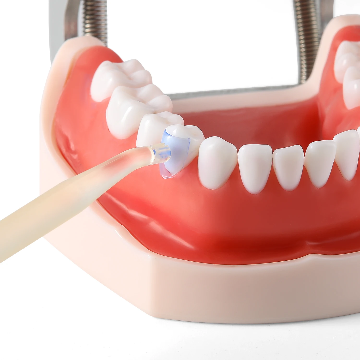 100 Stück/Set AZDENT Dental Matrix Blaues Klares Matrixband-Kit für Komposit-Gingiva-Zahnmedizin-Werkzeuge und -Materialien mit 2 Griffen – Detail 5