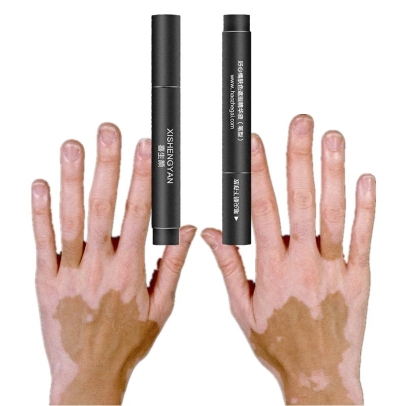 Skin Vitiligo Concealer Makeup Cream Pen Longlasting Waterproof No