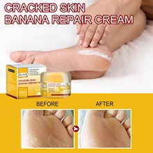 

Eelhoe Cracked Skin Banana Repair Cream Heel Dry Cracked Moisturizing Cream Banana Oil Removal Callus Dead Skin Hands Feet Care