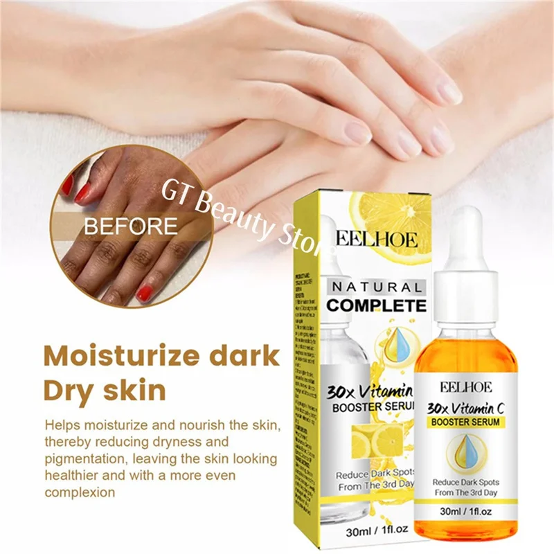 Dark Knuckles Fast Brighten Serum Elbows Hand Knuckle Brightening Serum Knee Black Skin Quickly Lighten Stains Remover Essence 6
