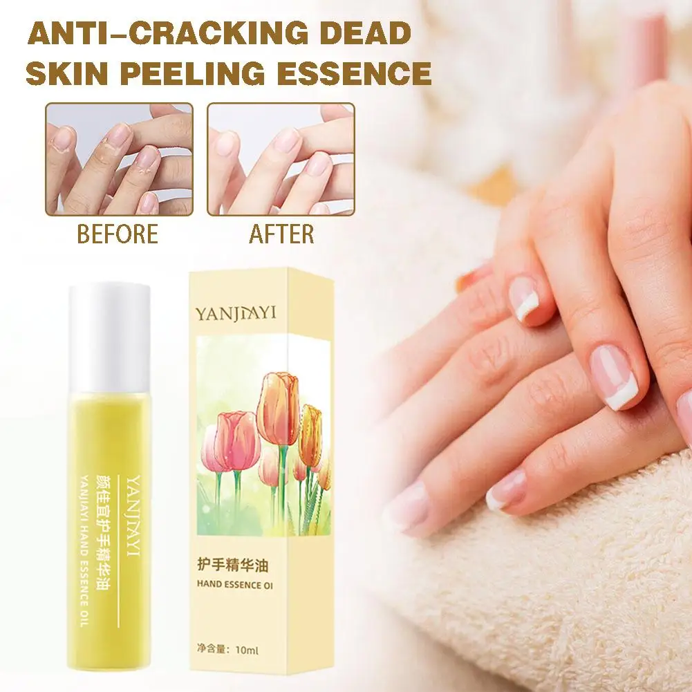 

Anti-Cracking Dead Skin Peeling Essence Oil with Natural Nutrients for Dry Cracked Hands Anti-drying Hands Repair Serum, 10 Q5Q6