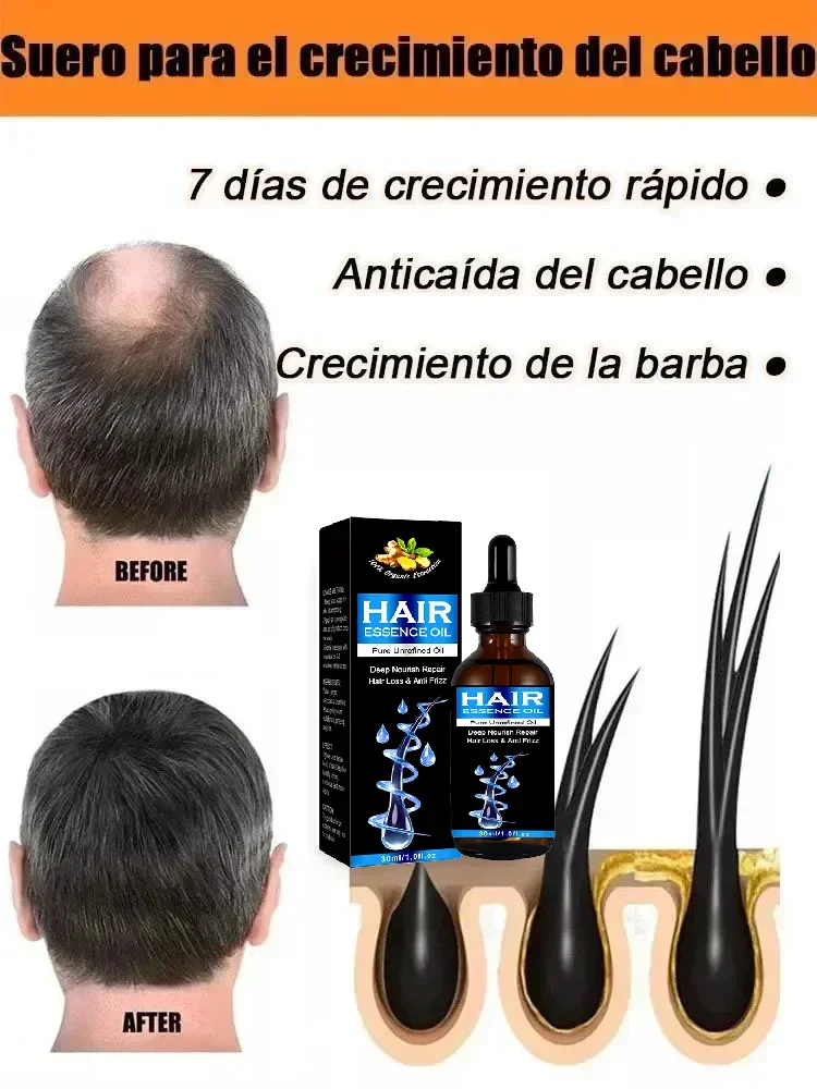Hot selling product, 99% of buyers buy again, have more and more hair, say goodbye to baldness, thick hair
