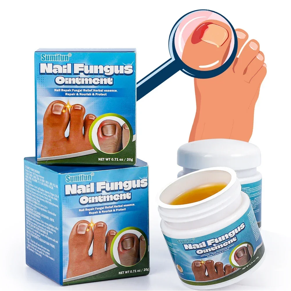 Nail Fungus Remover Treatment Cream Anti Infection Onychomycosis Paronychia Repair Gel Toe Nail Fungal Removal Hand Foot Care Products