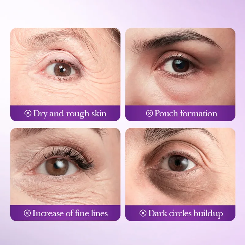 SADOER Grape Crystal Collagen Eye Mask Anti Dark Circles Removal Eyes Bags anti-aging Moisturizing Anti Wrinkles Eye Patches