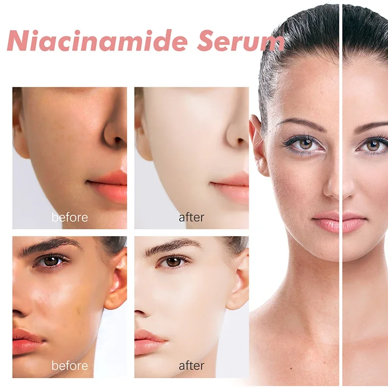 30ml Peach 70% Niacinamide Serum Moisturizing Prevent Dryness Facial Essential Oil Increasing Elasticity Smooth Soften Skin Care 3