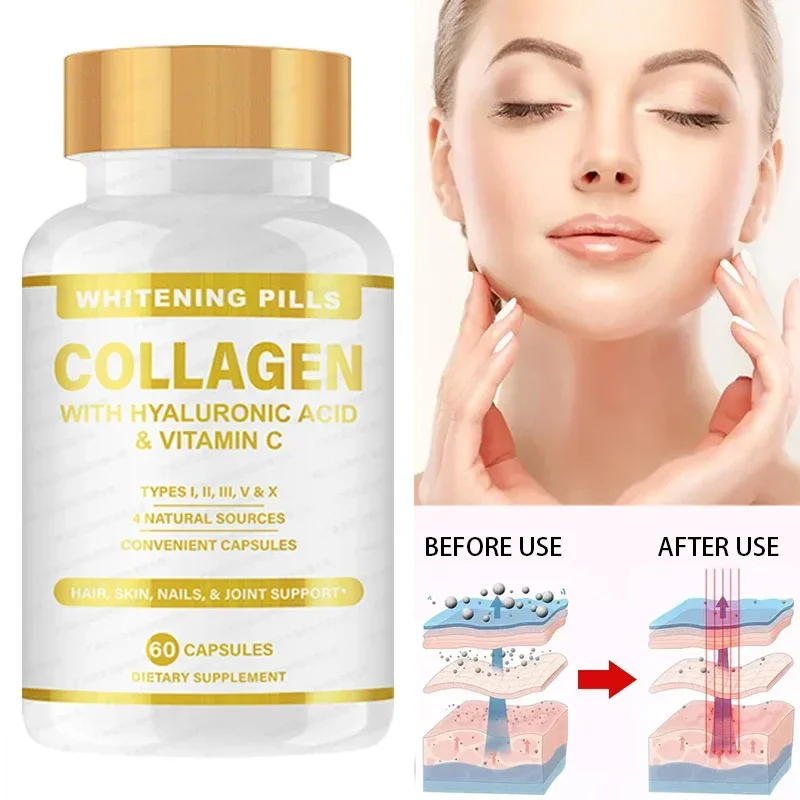 

1 Bottle Skin Whitening Collagen Capsule Supplemented with Vitamin C Whitening Skin Antioxidant Stress.