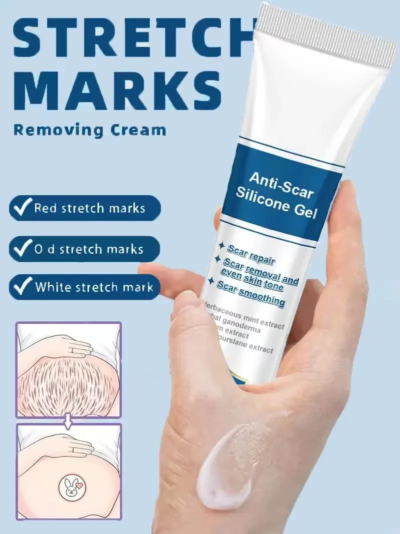 Stretch Marks Cream For Pregnancy Stretch Marks Removal Eliminate Red White Old Stretch Marks Oil