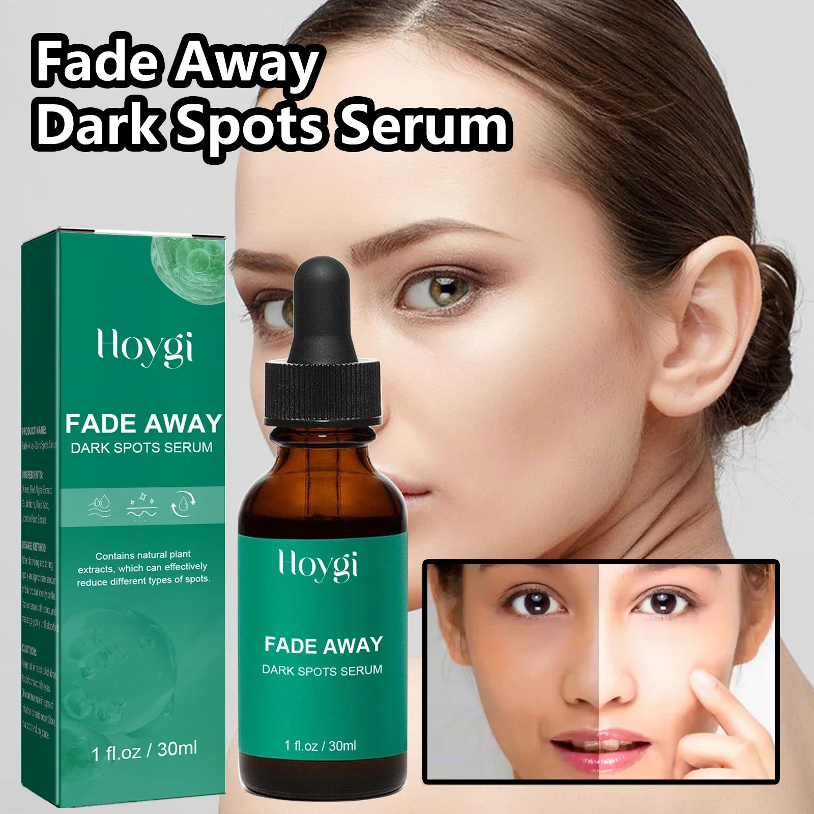 Dark Spot Remover Serum For Face Sun Melasma Freckles Pigment Age Spots Removal Freckle Whitening 4