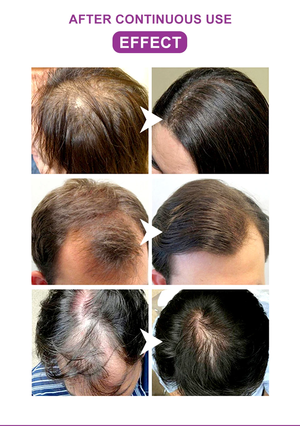 Description Picture 4 of itemOnion Black Seed Hair Oil Spray Faster Hair Growth Stop Hair Loss Thick Long Hair Traction Alopecia Chebe Hair Growth Product