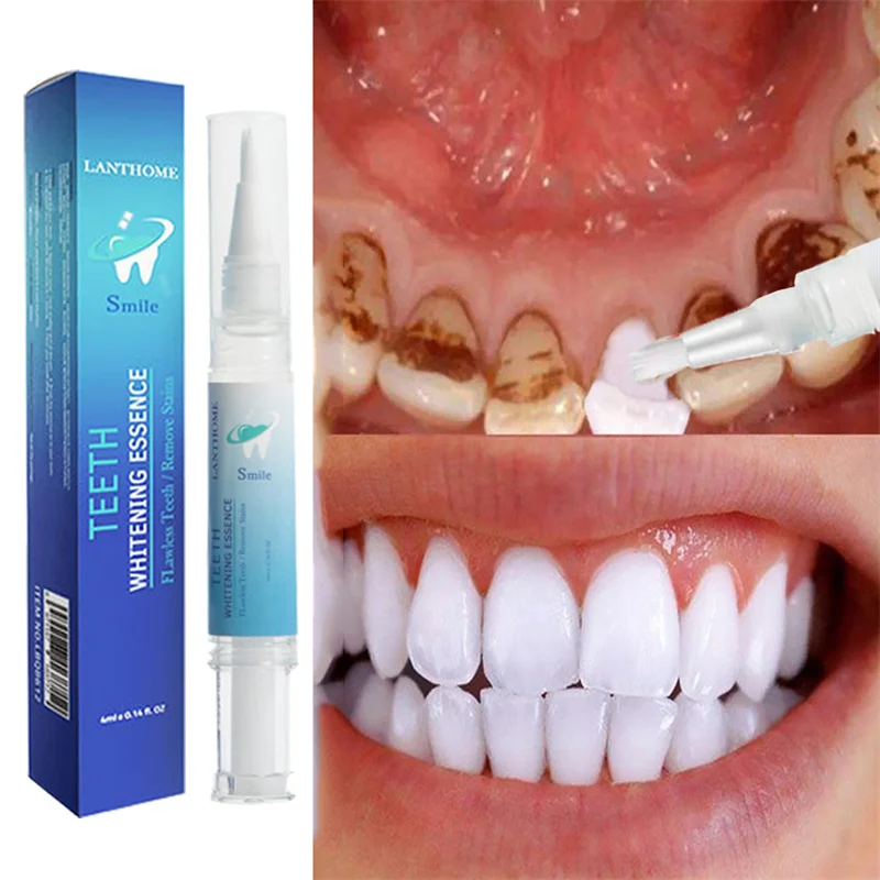 

Teeth Whitening Pen Deep Cleaning Dental Essence Serum Oral Hygiene Remove Stains Fresh Breath Bleach Tooth Care Tools
